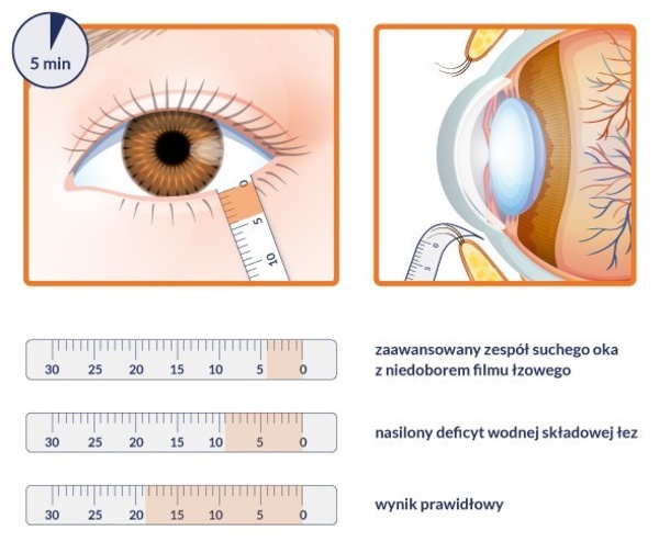 Zespół suchego oka - nowoczesna diagnostyka i leczenie w Sosnowcu
